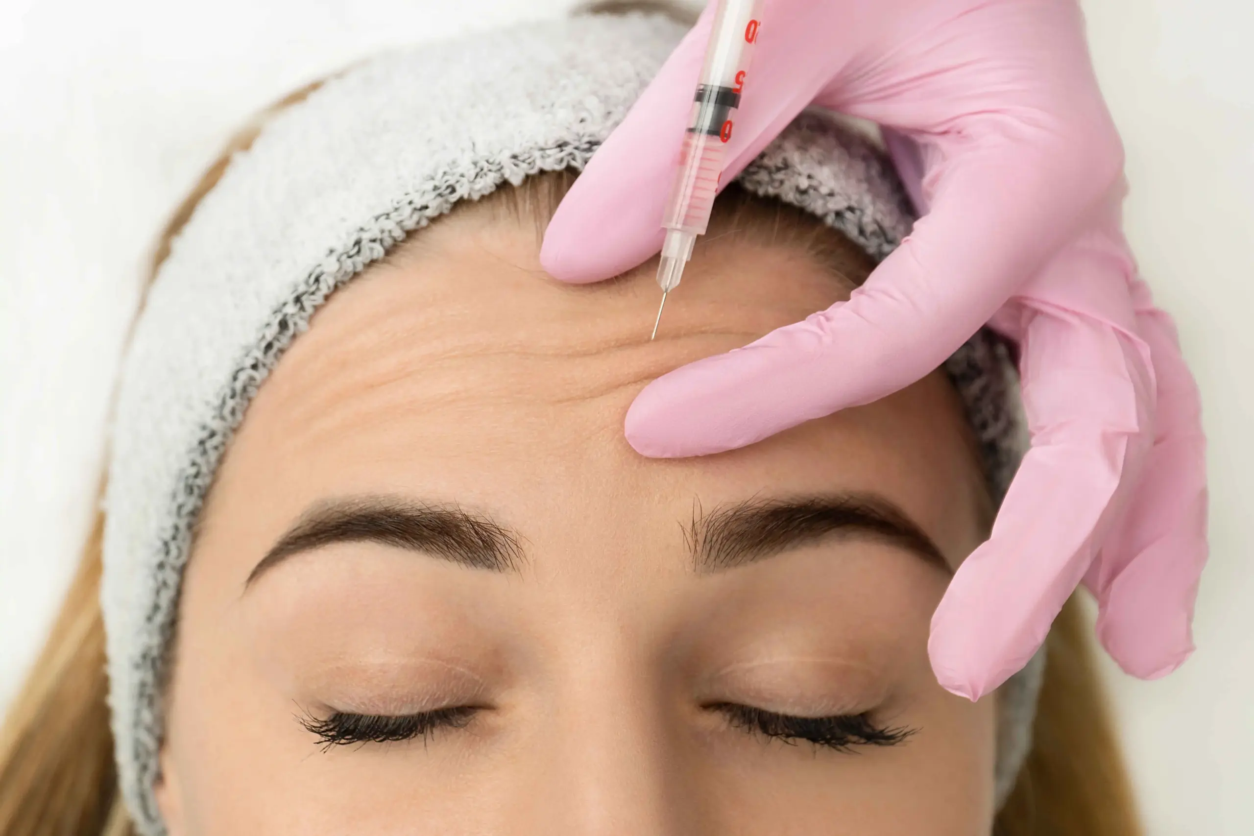 Botox for Forehead Lines